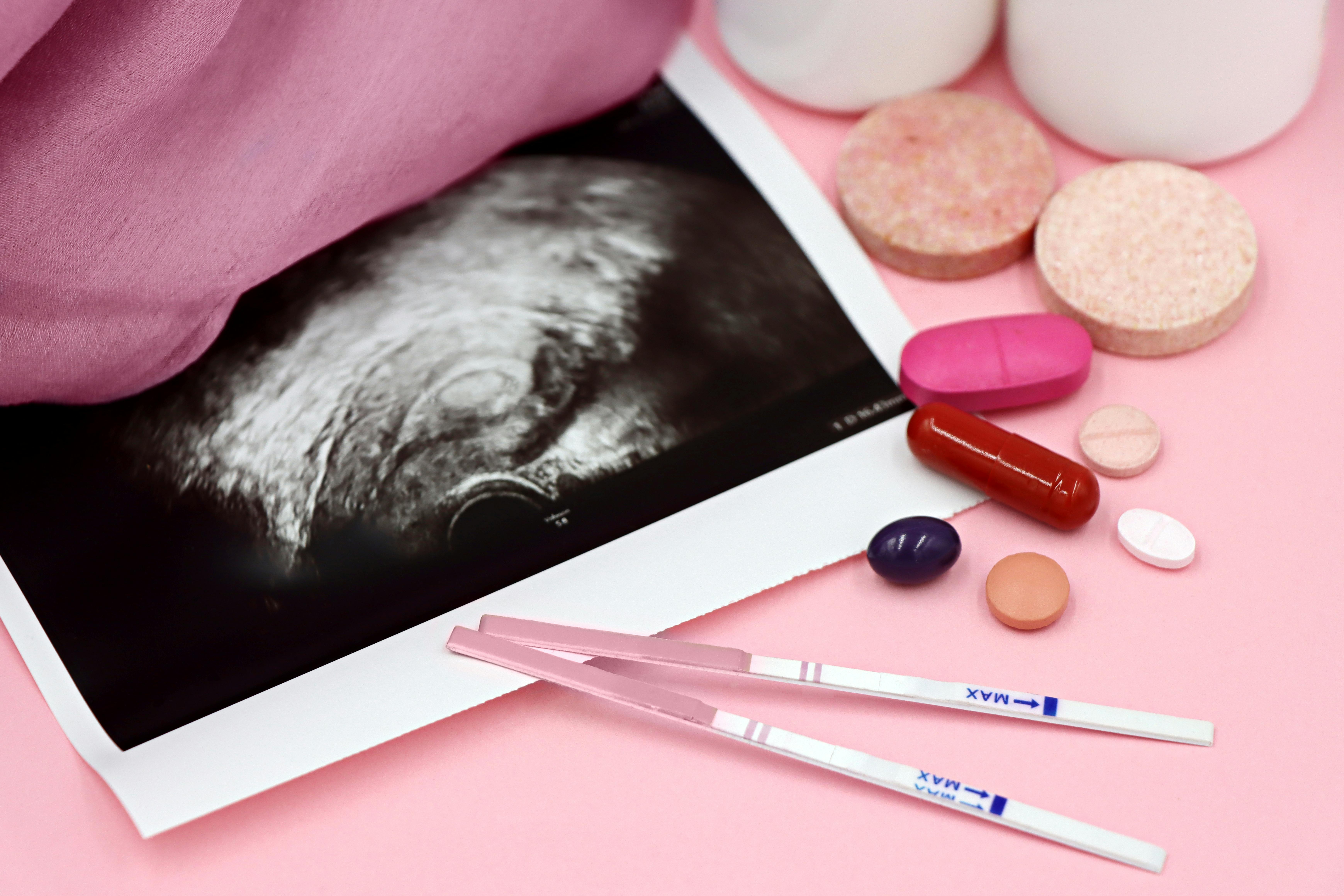A picture of an ultrasound with pregnancy or fertility pills to the right.